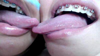 Deep tounge kissing between two brace lesbian on girlsporntube.one